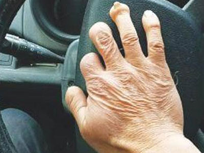 手指殘缺能不能考駕照？